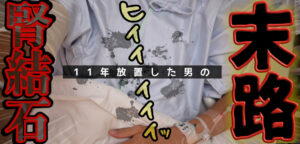 腎結石を11年放置したらどうなるか説明致しましょう。入院ブログ。